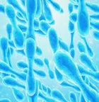 25 Billion CFU Probiotics for Advanced Gut Support