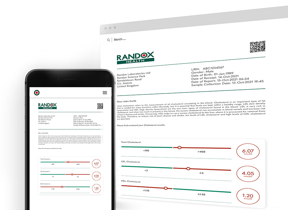 Randox Vitamin D - Blood Test Kit – MicroBio Health™